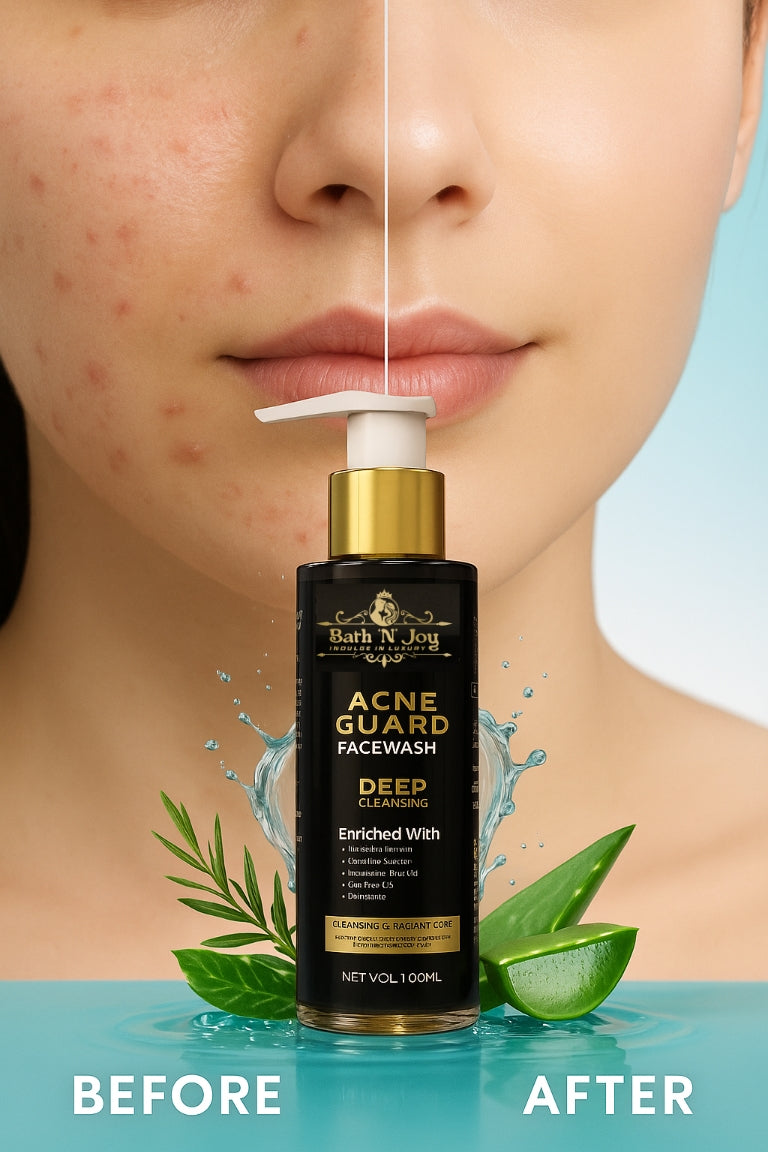 Acne Guard Facewash: The Best Facewash for Teens and Adults